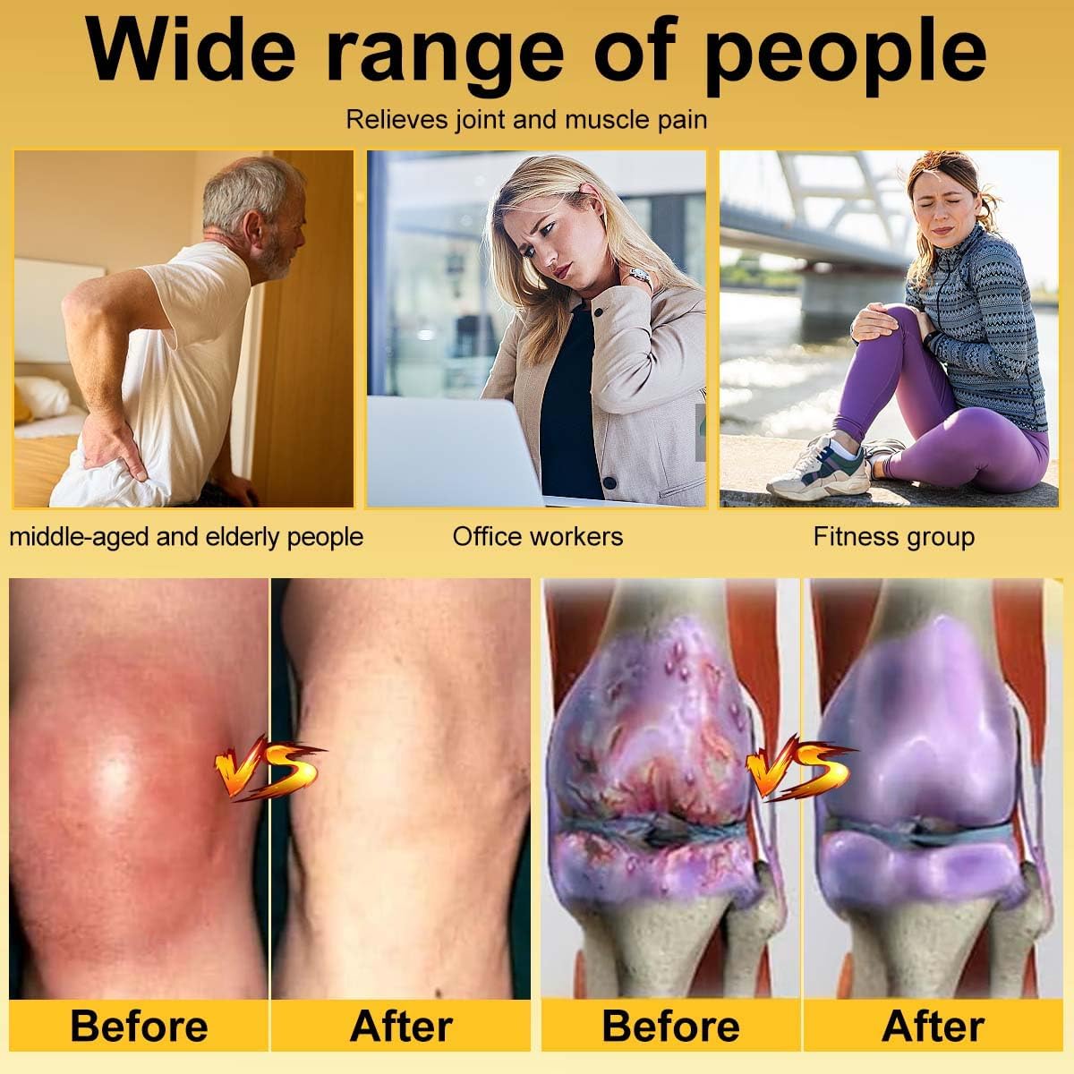 BeeCalm Joint Pain Cream